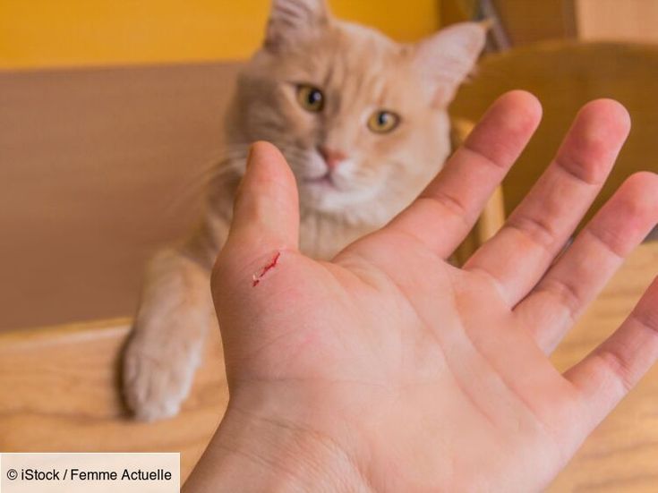 Cat Scratch Disease Penyakit yang Ditularkan Melalui Cakaran Kucing