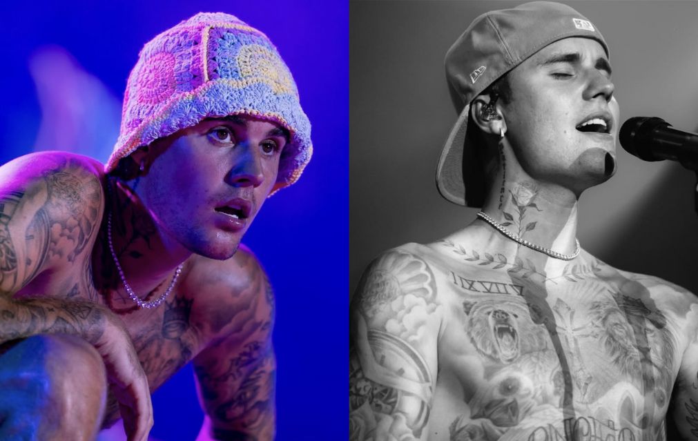 Bukan Sekadar Bell's Palsy, Ini Penyakit Langka yang Diderita Justin Bieber